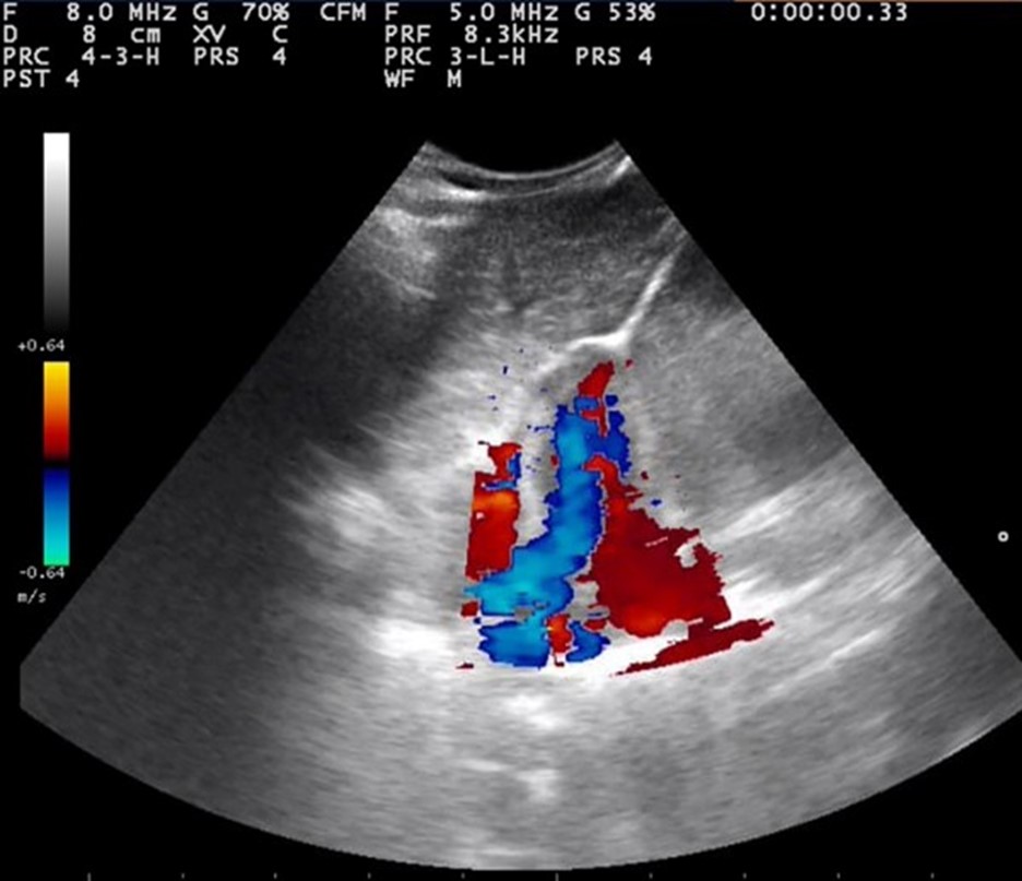 Ultrasound Ultrasound